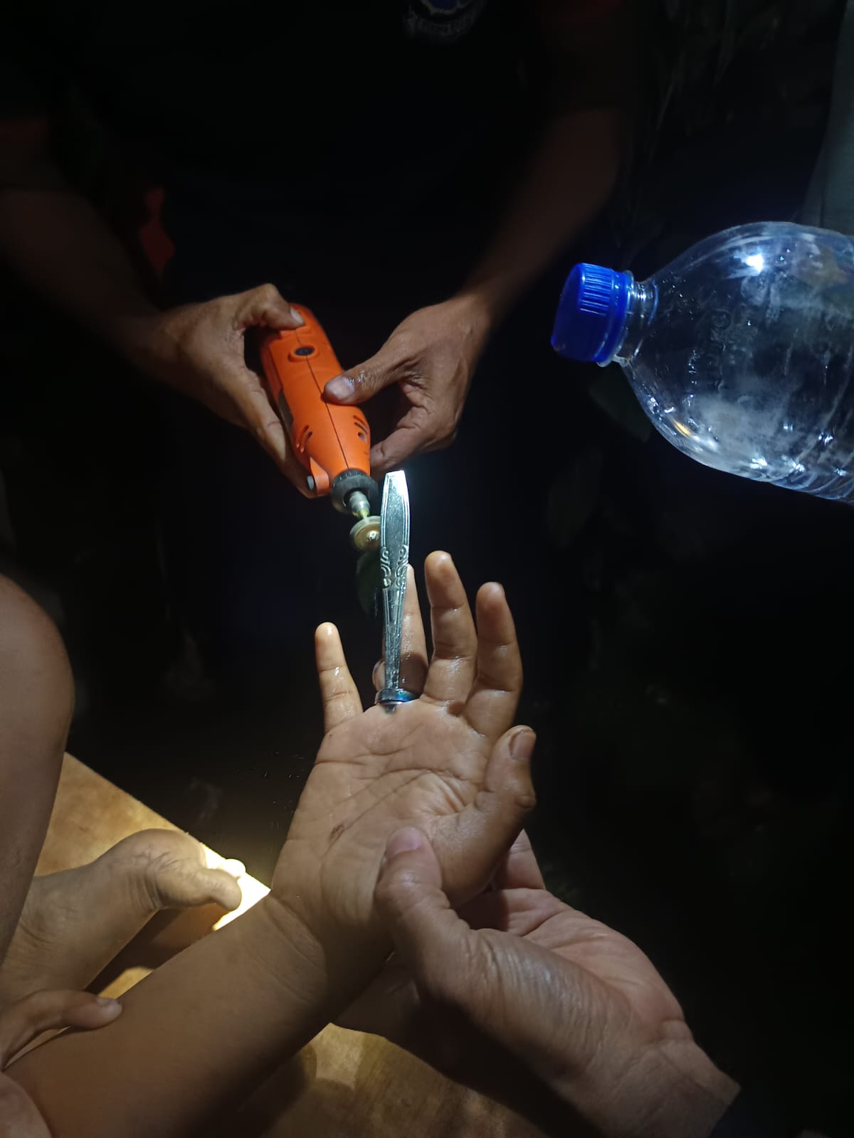 Damkartan Lombok Tengah Berhasil Lepaskan Cincin yang Tersangkut di Jari Remaja dalam Waktu 30 Menit